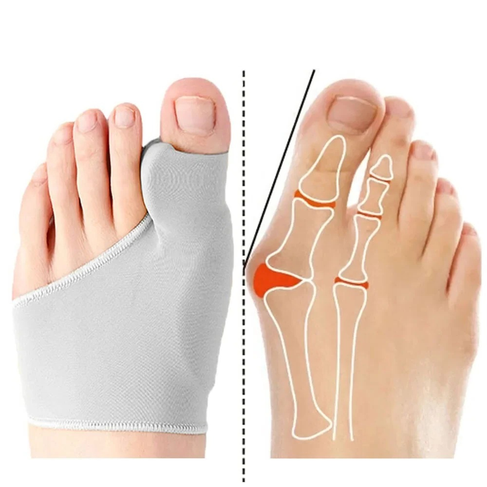 1/2 쌍 발가락 분리기 Hallux Valgus Bu - Ankle Brace Sock 리뷰 및 가격